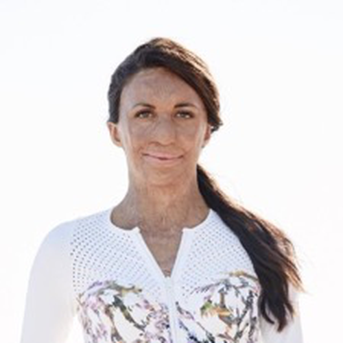 Turia Pitt